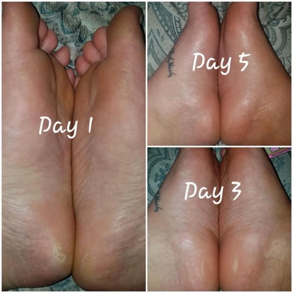 Pedicure in a bottle - Picture 5 of 9